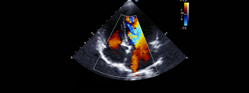 color doppler test in das multispeciality hospital chembur mumbai