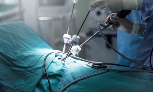 General & Laparoscopic Surgery Department